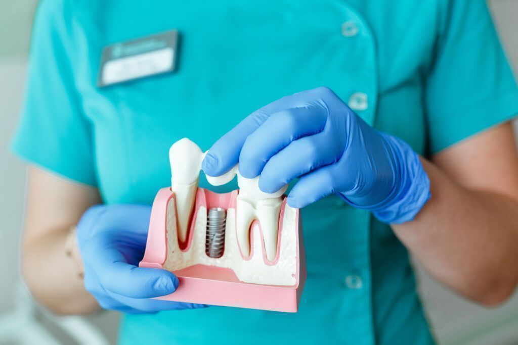Dental implantology: what is it?